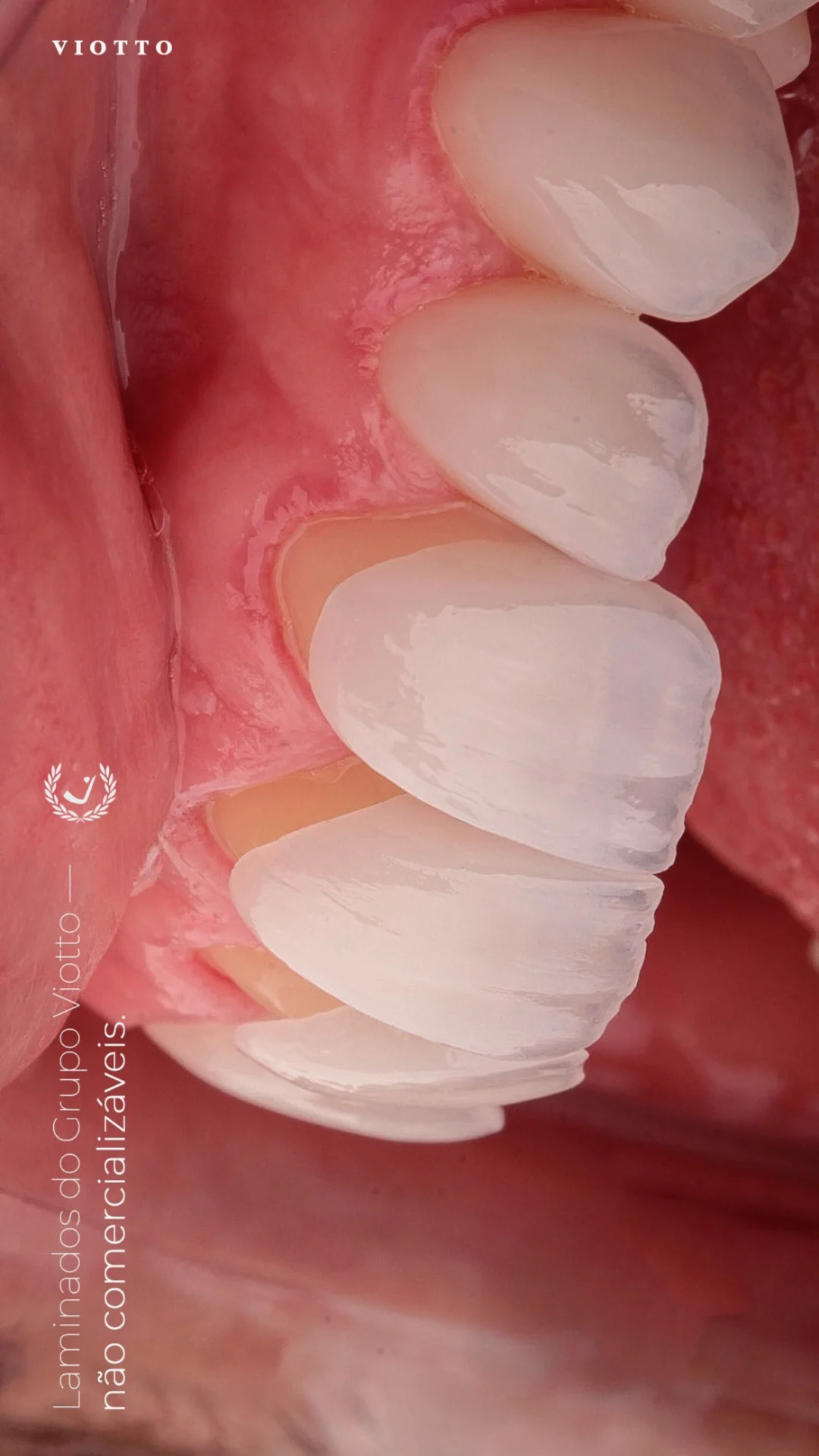 DETALHE 3