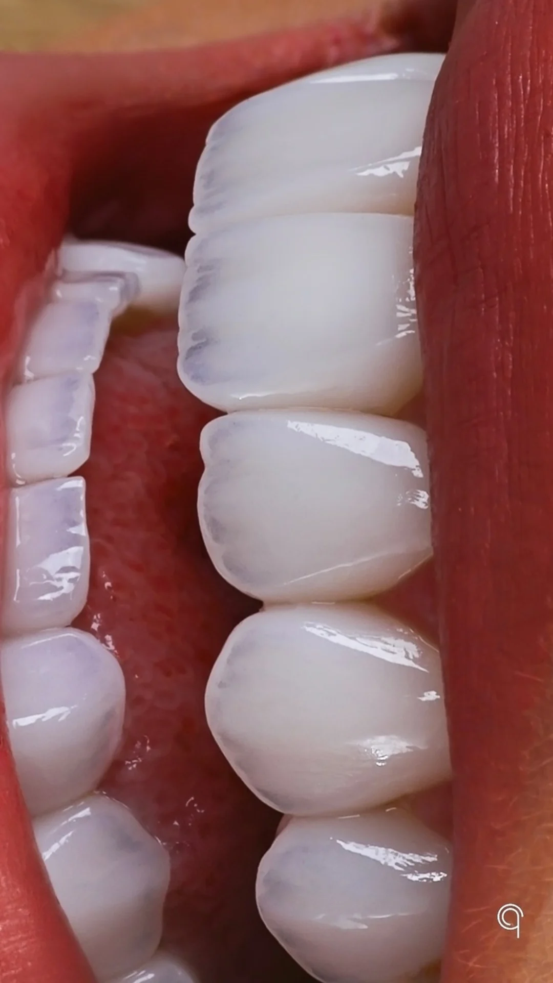 DETALHE 4