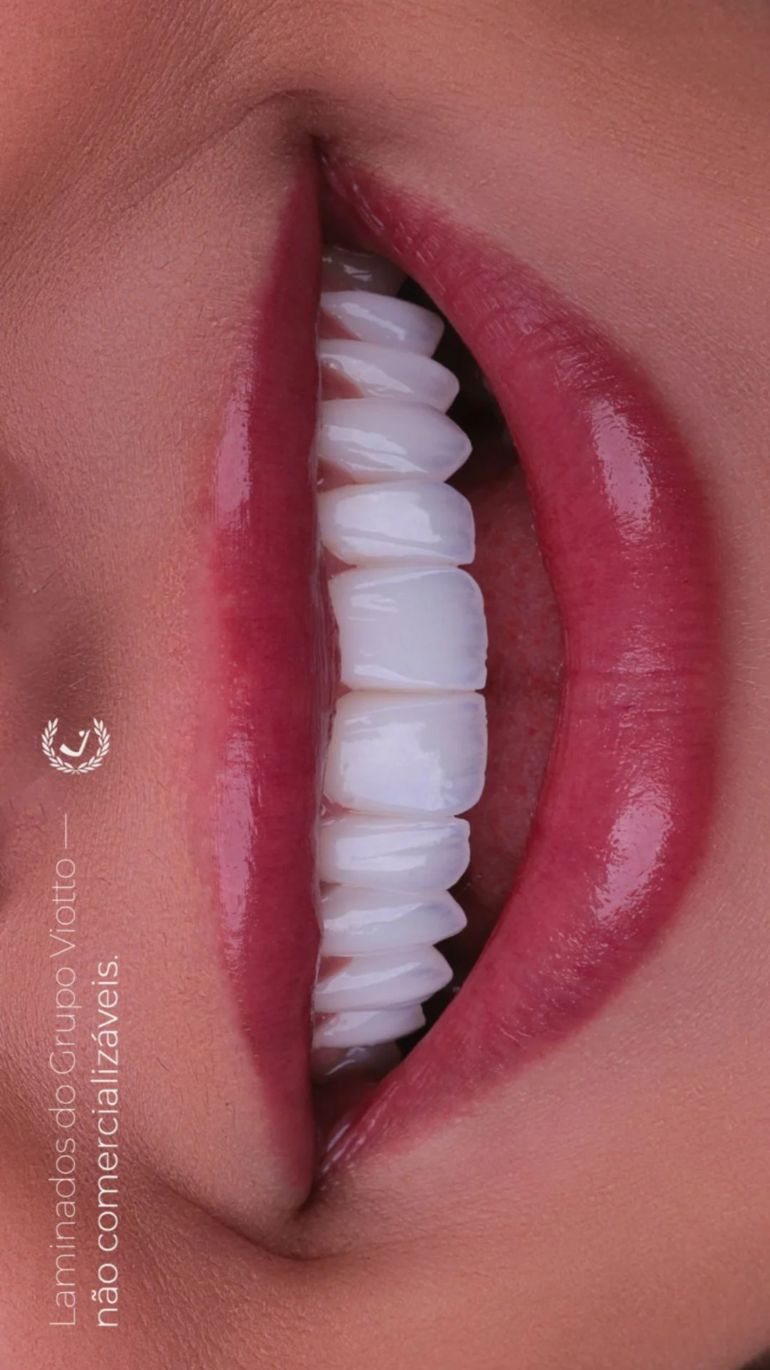 DETALHE 5
