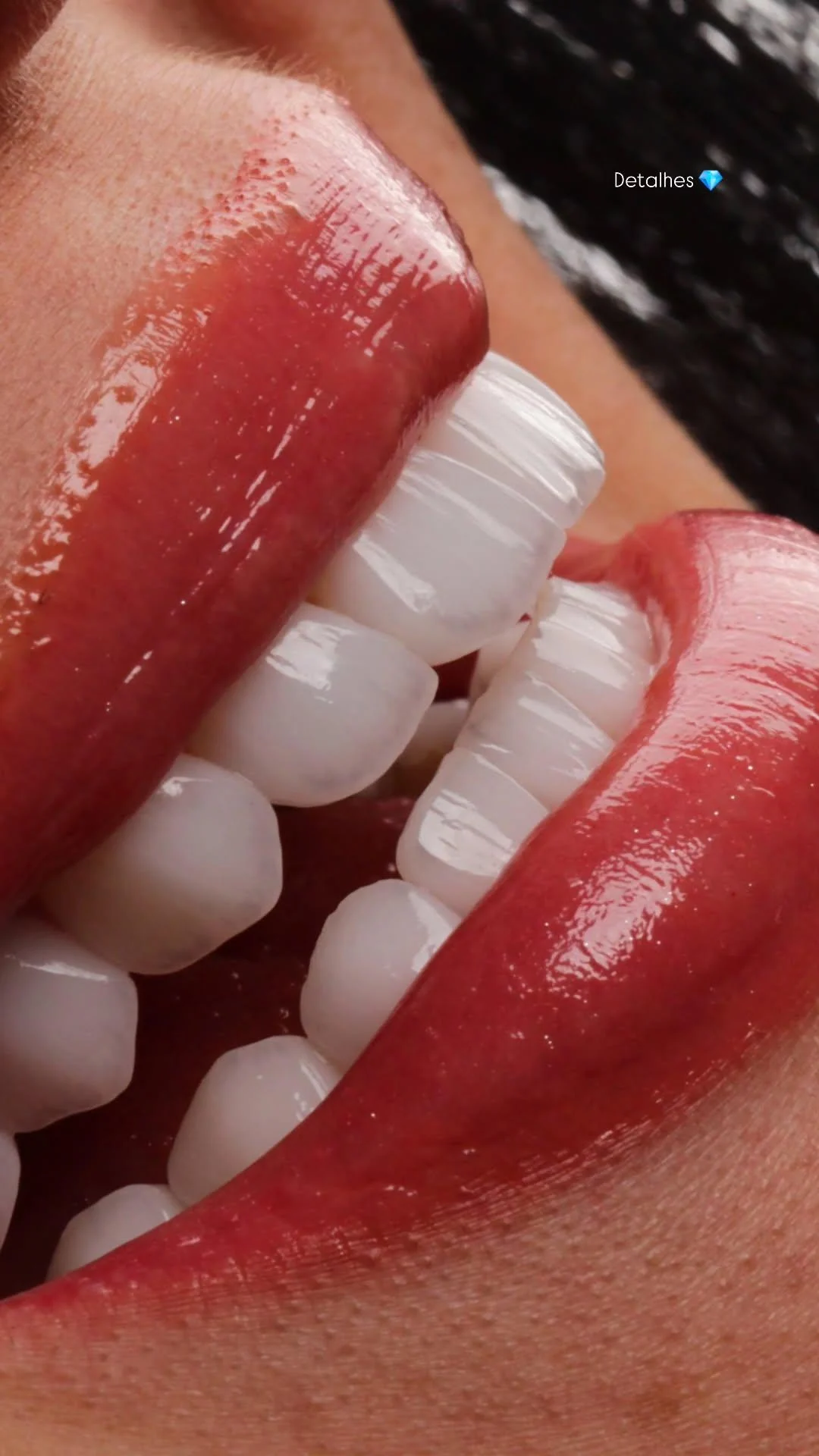 DETALHE 6