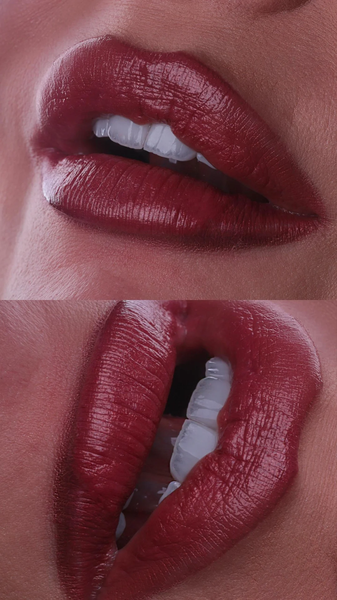 DETALHE 9